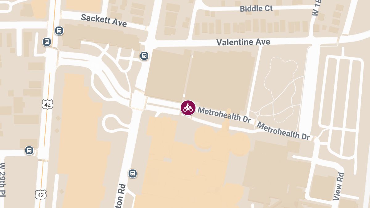 Dirt Bike Rider Injured in Crash Near MetroHealth Dr